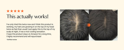 Growturn Hair Serum with Brush 100ml