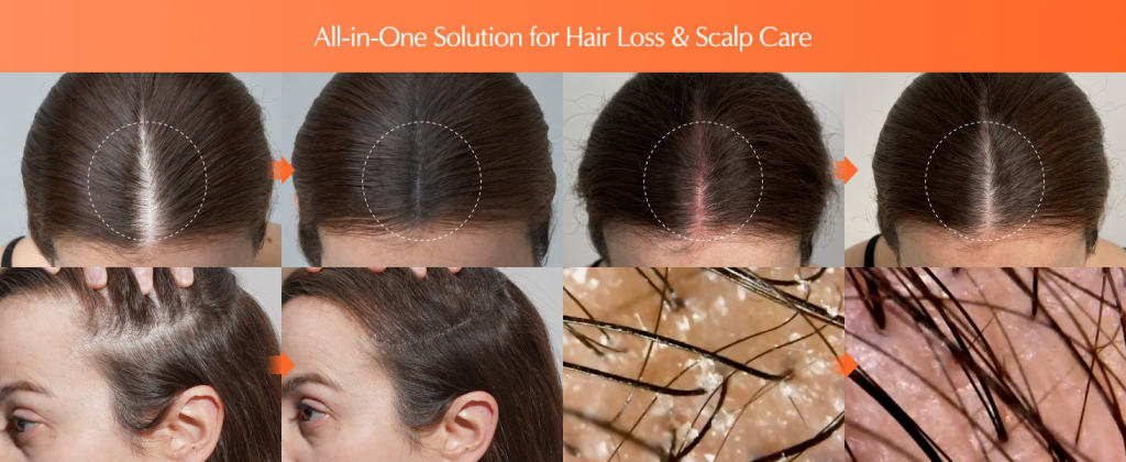 Growturn Hair Serum with Brush 100ml