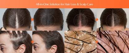 Growturn Hair Serum with Brush 100ml