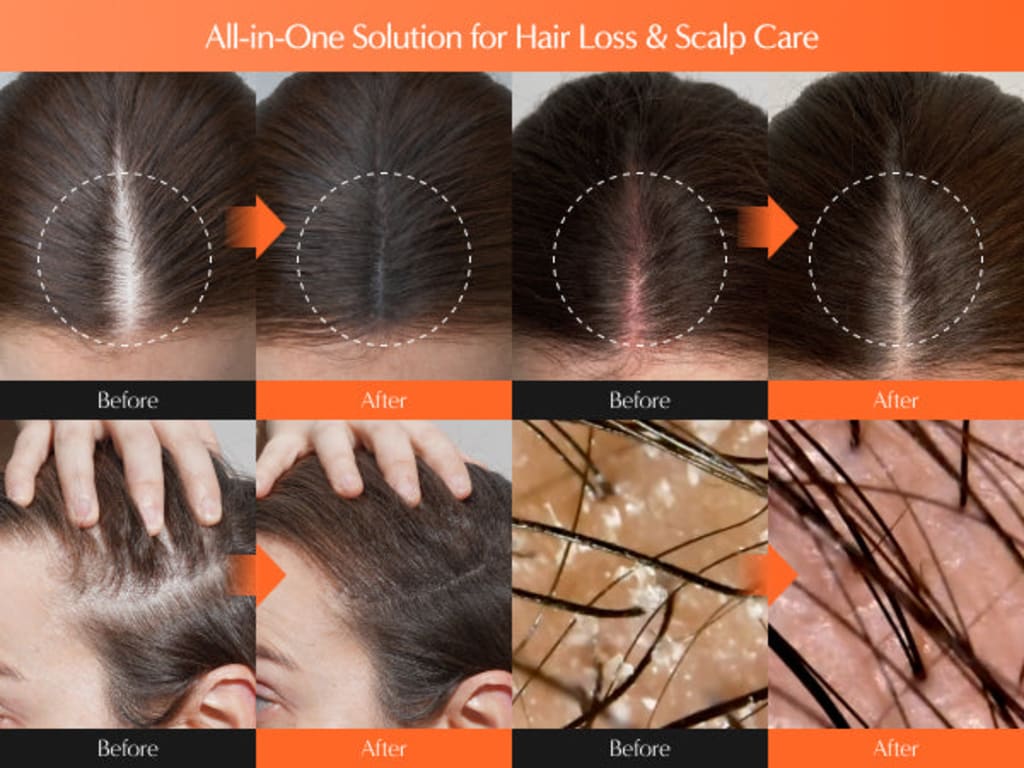 Growturn Hair Serum with Brush 100ml